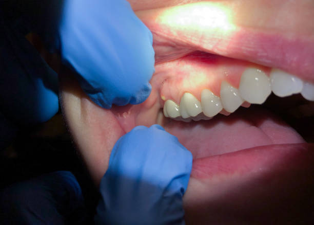 Best Weekend Emergency Dentist in North College Hill, OH